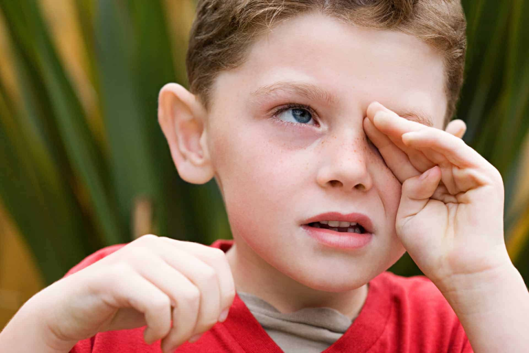 What Do You Do When Your Child Has Eye Allergy?