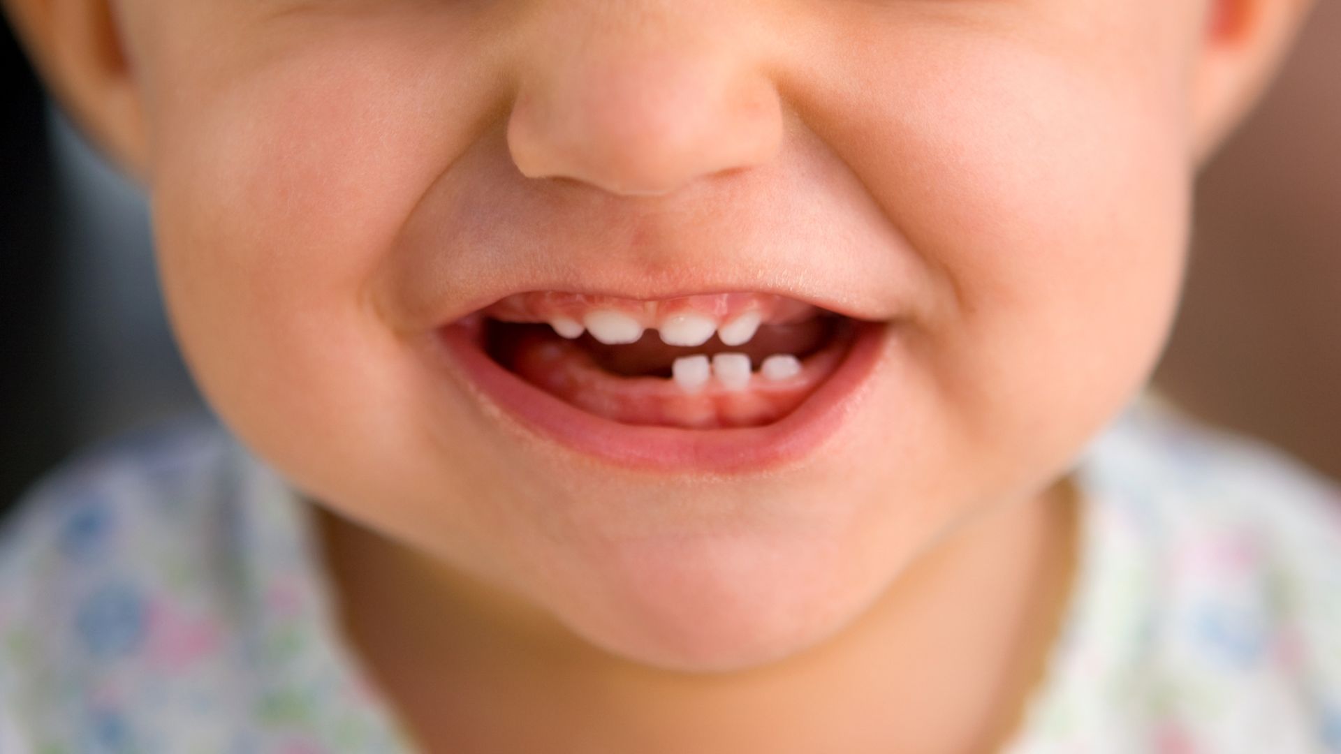 baby upper teeth before eruption