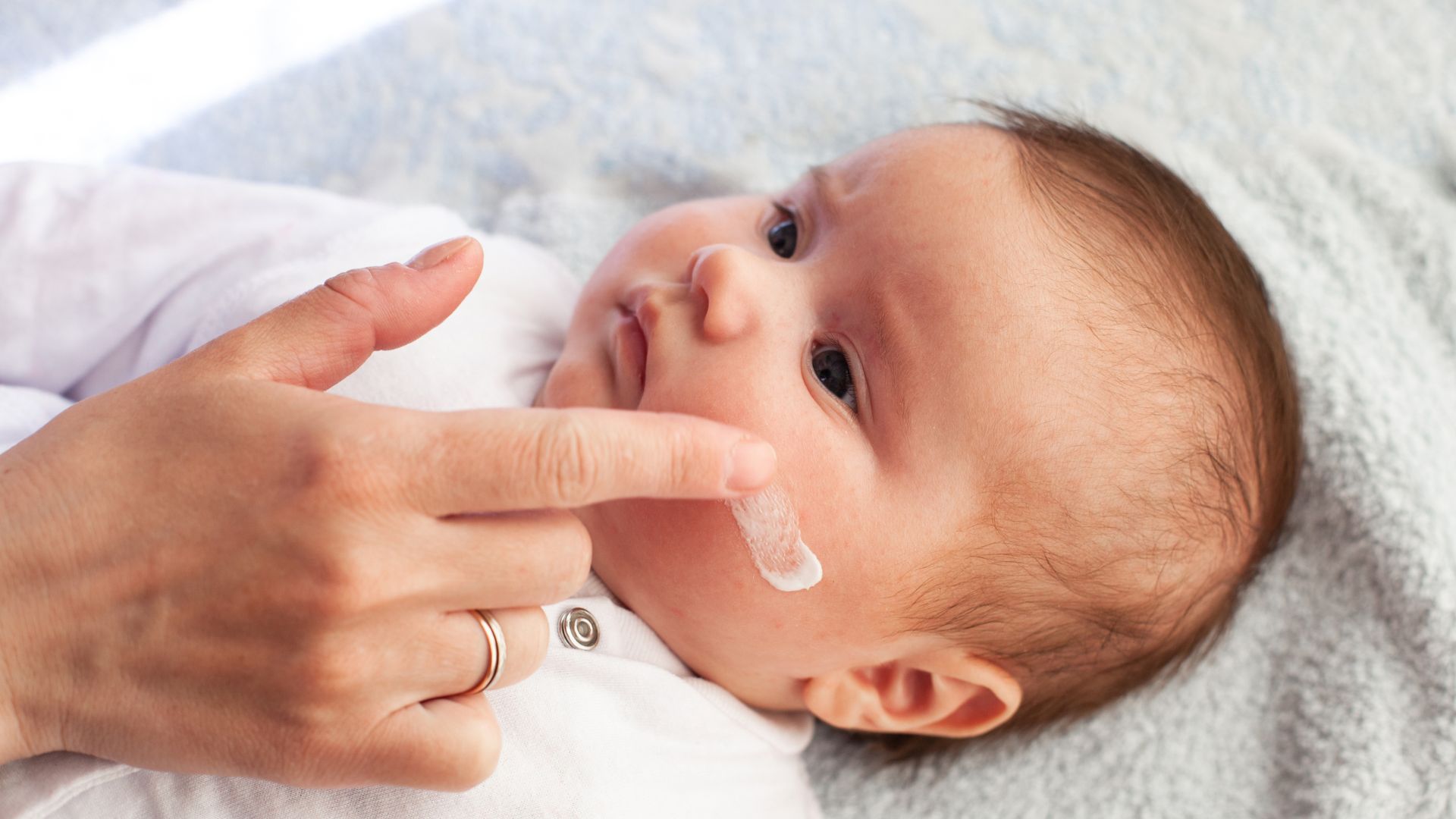 best eczema cream for kids